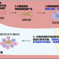 降尿酸初期反而更痛怎么办？2026年高尿酸科学调理方案