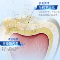 几块到几十块的牙膏差在哪?牙科博士教你看懂成分再下单