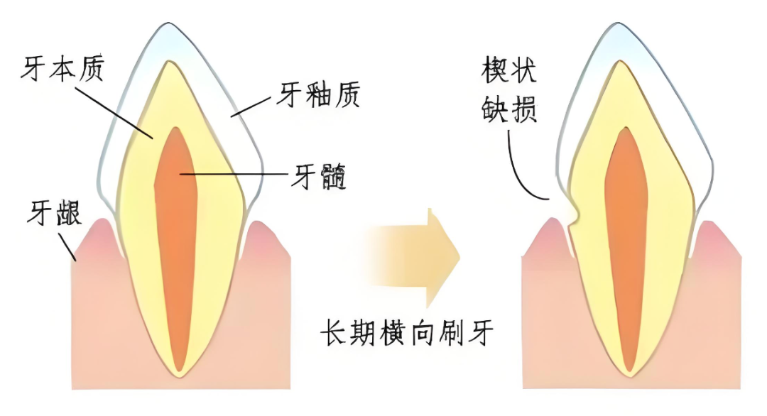 老人一口牙被全口拔光,最该反思的不止是医院