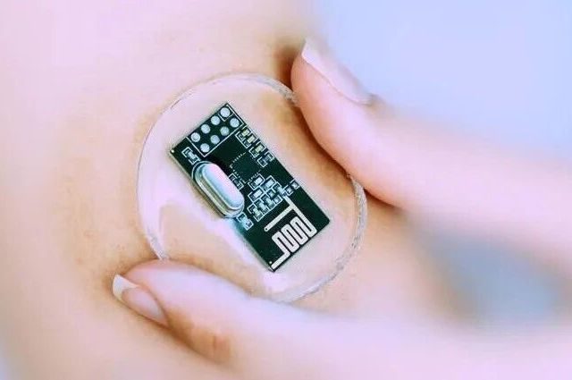 国内首款闭环人工胰腺获批在即！胰岛素泵用户：先别急着买