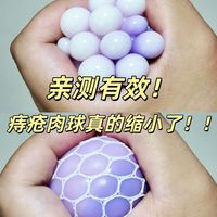 告别难言之隐！如何摆脱痔疮烦恼！