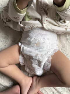 贝肽斯胎脂皮防护大师护臀裤，我家夏天红屁屁的救场选手