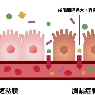 肠漏是万病之源还是营销噱头？这篇说清楚了