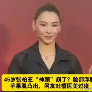张柏芝商演状态引热议，苹果肌浮肿显僵硬，网友：像AI机器人