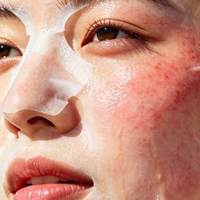 屏障不稳肌优选｜含龙胆植萃修护面膜 5 款实测合集
