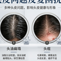 油痘屑痒头皮问题避坑指南：2026二硫化硒洗发水实测对比