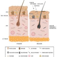 连续熬夜皮肤垮了？别急着上猛药！皮肤科医生教你避开这3个坑