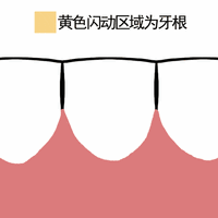 牙龈萎缩不可逆≠没救！医生说出真相，看完瞬间清醒