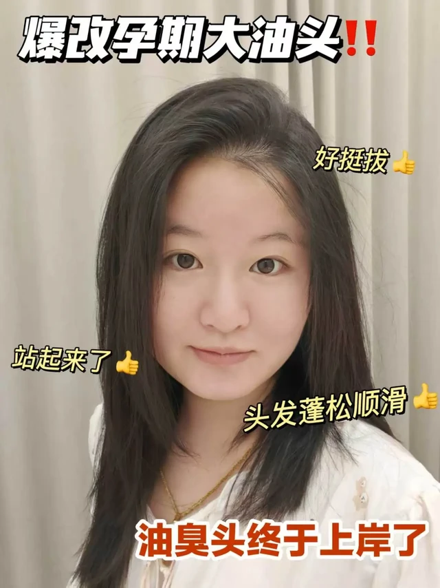 孕期一天不洗就头油？这下终于找到救星了