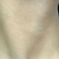 25+去颈纹用什么颈纹霜?达人分享,抗皱紧致淡纹
