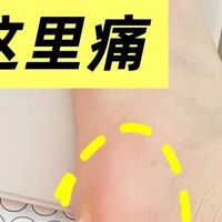 30秒避坑！足底筋膜炎:越做越疼的4个操作