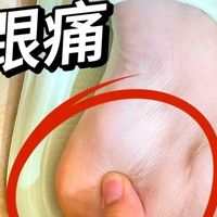 足底筋膜炎舒服多了（我的经验）