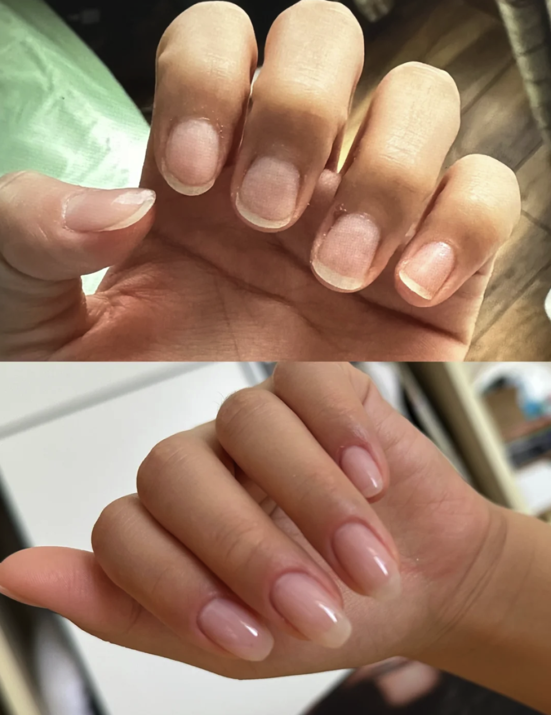 指甲缝里的黑泥到底是什么？抠出来一闻，滂臭！