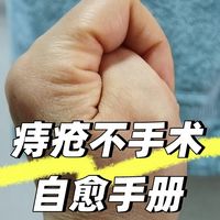 怎样才能永远不长痔疮？有痔疮怎么办？