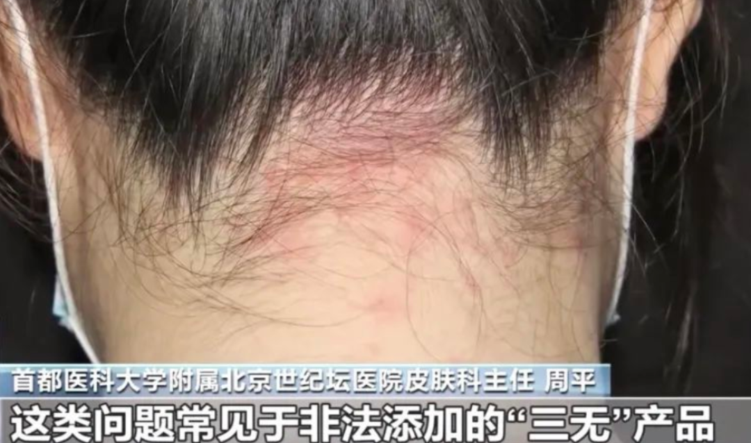 宫廷秘方是猪油、防晒不加防晒剂、蟑螂作坊...我是来消费的，不是来打怪的