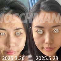 把两张阶段照片放在一起，我更看重稳定护理的过程
