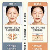 眼角细纹不管它，3-5年就“定型”成静态纹！皮肤科医生教你看懂皱纹类型