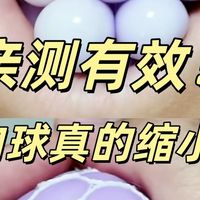 便血肉球脱出？别把肠癌当痔疮治！