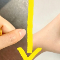 长痔疮怎么办？过来人对痔疮的指导建议（家常版）