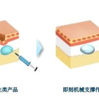 不吸水不馒化维持2年的抗衰填充，比玻尿酸好在哪