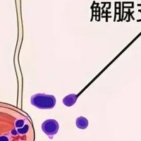 汇总：中医治疗解脲支原体感染的常用中药方