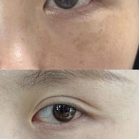 花再多钱都白不了？皮肤科医生终于说出真相：多数人一直做错了这6步