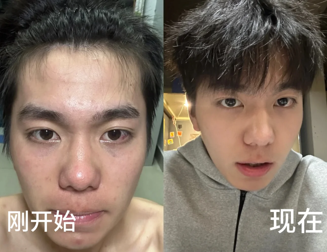 撞脸马斯克爆火！40多岁还能有年轻感？关键做好这3件事