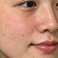 晒伤后续：急救面膜+维稳面霜一周实测 晒后褪红修护好CP