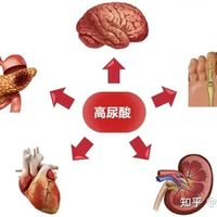 脚从没痛过，一查就是肾衰竭！高尿酸最可怕的从来不是痛风