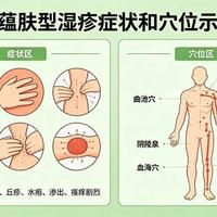 长湿疹别急着祛湿！中医分3种类型，只有1种越祛越干