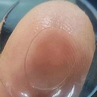 散光超过75度就别戴普通隐形了！眼科专家说出必须换镜的真相