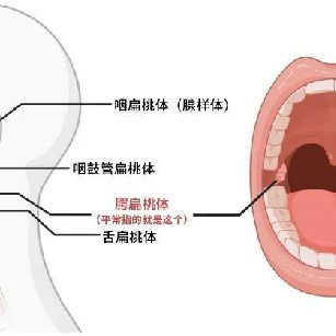 重庆耳鼻喉科普：儿童鼻炎腺样体肥大易致中耳炎
