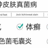 无激素安心用！顽固脚气直接拜拜