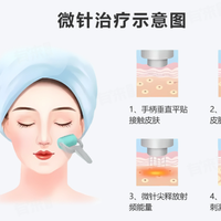 黄金微针做完皮肤反黑？医生：术后72小时的10个坑，一个别踩
