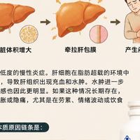 授白水飞蓟能阻止脂肪肝恶化吗会变肝硬化吗