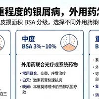 确诊牛皮癣，外用药膏怎么选？一文教你对症挑选