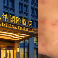 维也纳客房到处是吸饱血床虱，住客维权反被怼：你不会自己检查？