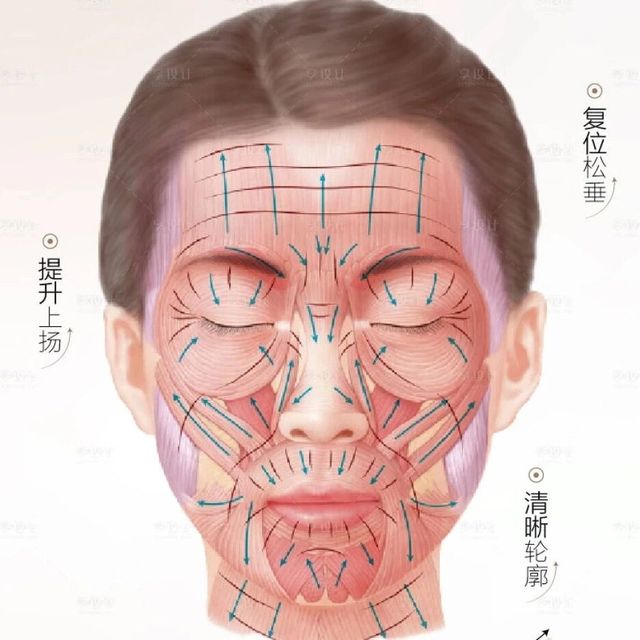 一针"支棱"全脸？扒开英伦大提升的真面目