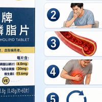 体检查出脂肪肝需要马上吃护肝片吗
