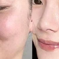 油皮美白护肤品推荐：4款去黄提亮水乳实测，油痘肌夏季适配方案