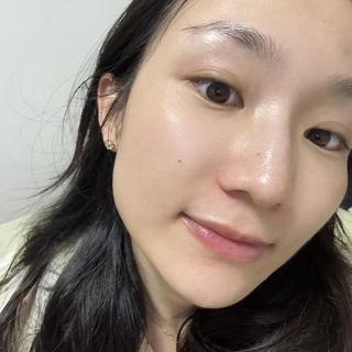油皮用完泛红刺痛？兰蔻极光水真实测评：适合谁、怎么用、值不值买