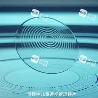 星趣控售后升级：365天保障散光也算，这些细节不确认可能白花钱