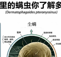 皮炎反复？中科院团队实测揭秘：卧室空气中漂浮的菌螨才是真凶！