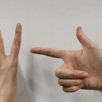小拇指托手机骨头不会永久变形，但腱鞘炎要当心