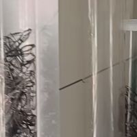 深圳青光眼筛查好机构先看检查流程