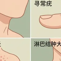 身上突然冒的小疙瘩，这4类千万别抠！越挠越严重