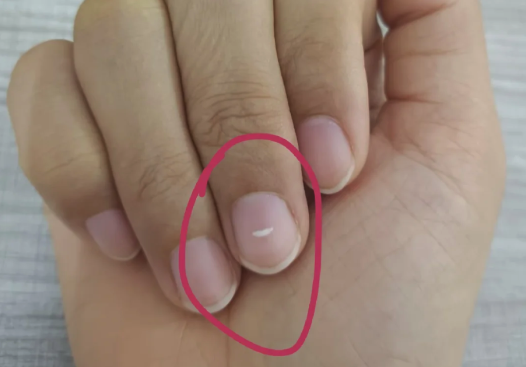 手上没有月牙,就是体虚?别被指甲传言骗了