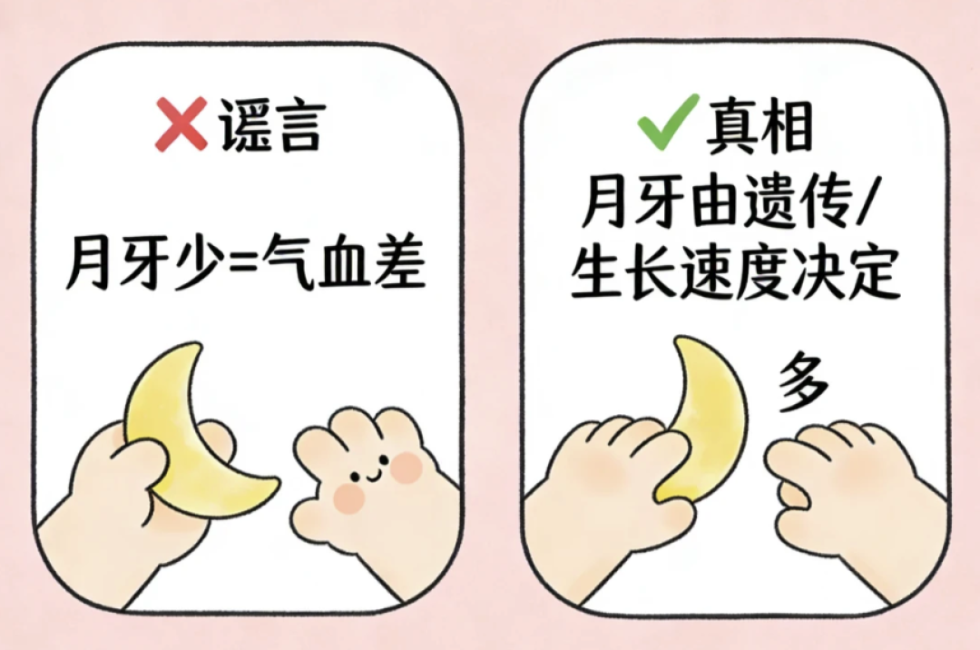 手上没有月牙,就是体虚?别被指甲传言骗了