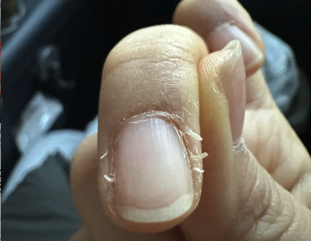 手上没有月牙,就是体虚?别被指甲传言骗了