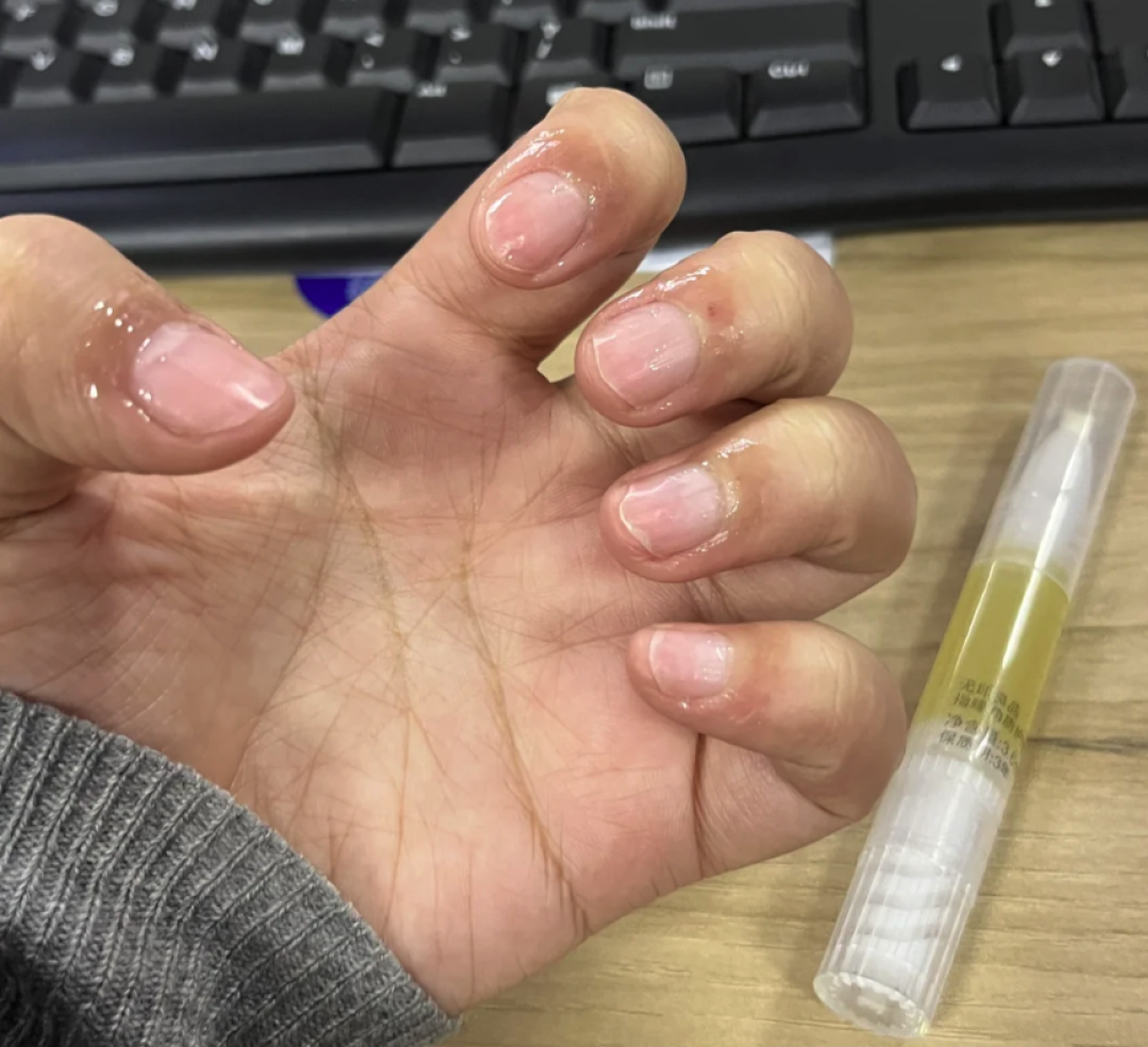 手上没有月牙,就是体虚?别被指甲传言骗了